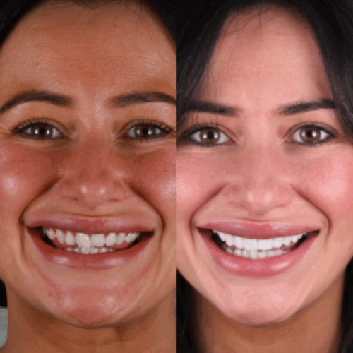 Transformation 3