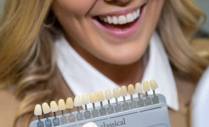 Blog - London Dental Arts