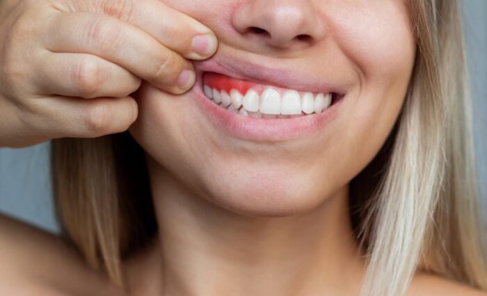 Blog - London Dental Arts
