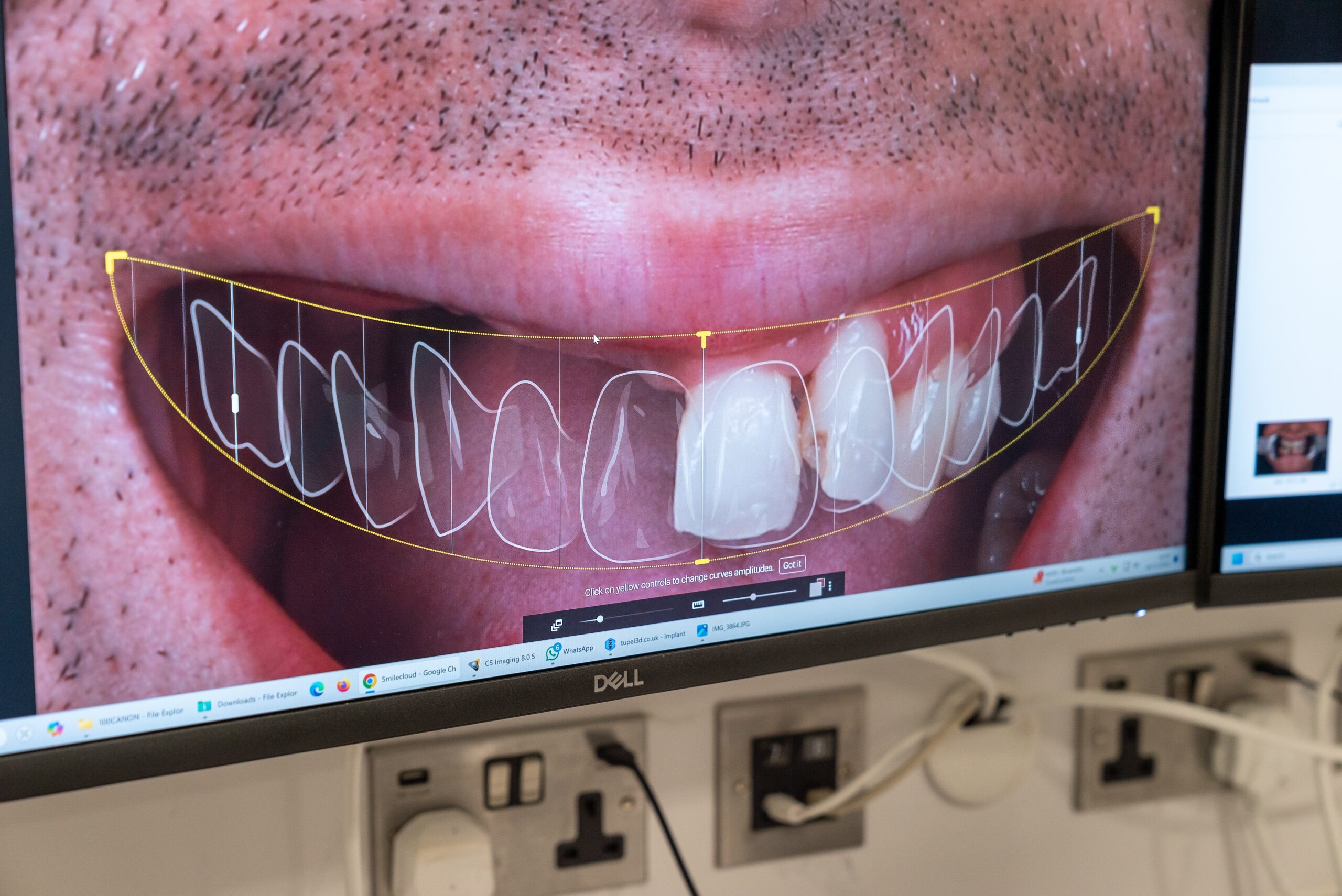 Implantology Image 1