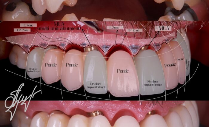 Blog - London Dental Arts