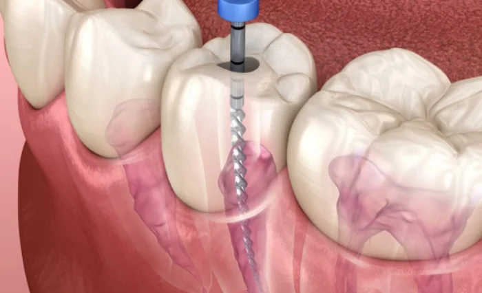 Blog - London Dental Arts