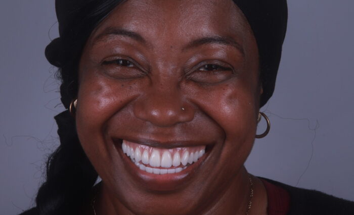 Blog - London Dental Arts