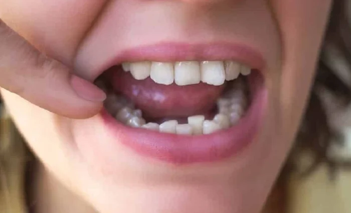 Blog - London Dental Arts