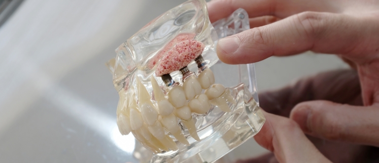 Bone Grafting/Sinus Lifting