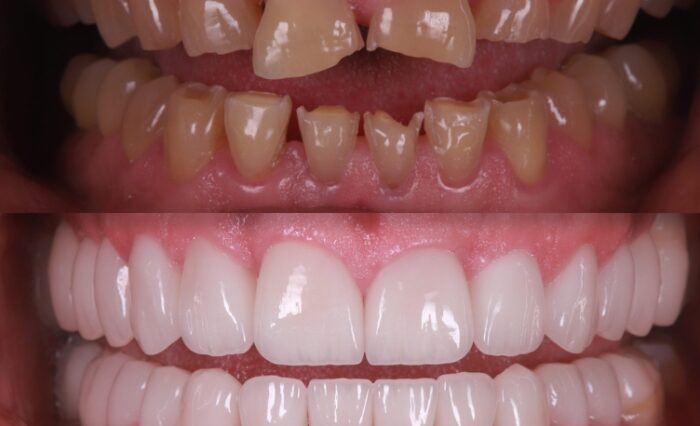 Tooth Wear in Motion 17-18 April 2026