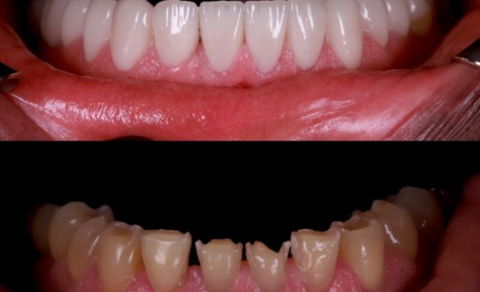 Tooth Wear in Motion 28 Feb – 1 March 2026