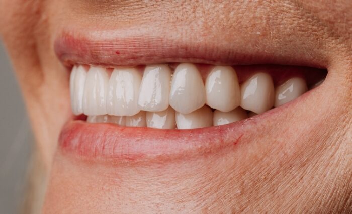 Modern Full Arch Implantology & FP1 Prosthetics 12th and 13th of June 2026
