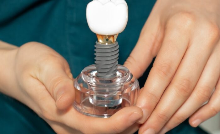 Modern Full Arch Implantology & FP1 Prosthetics 20th and 21st of November 2026