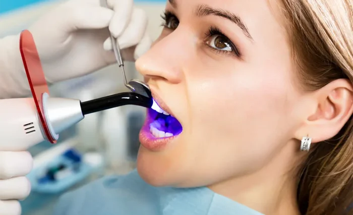 Blog - London Dental Arts