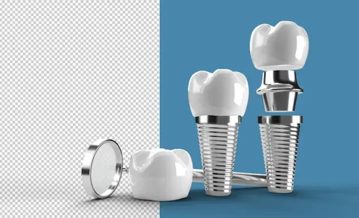 Blog - London Dental Arts