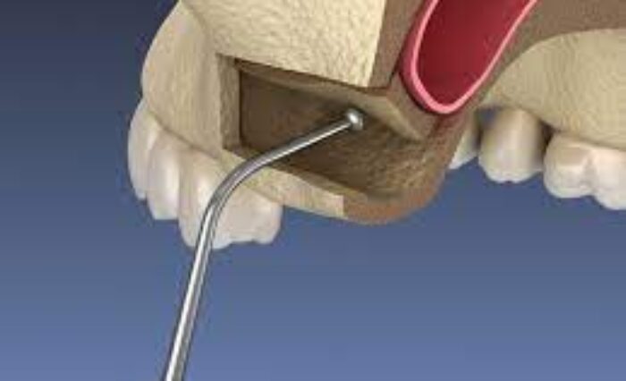 Blog - London Dental Arts