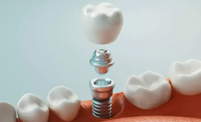 Blog - London Dental Arts