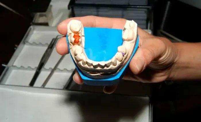 Blog - London Dental Arts