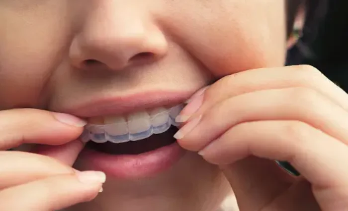 Blog - London Dental Arts