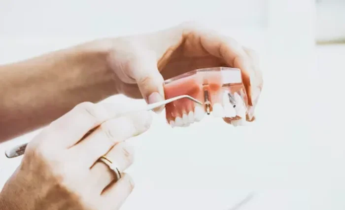 Blog - London Dental Arts