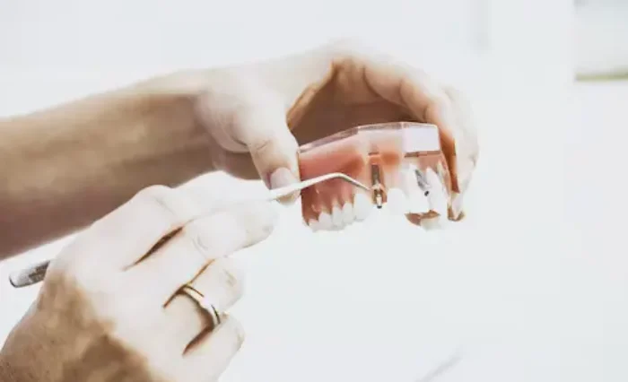 Blog - London Dental Arts