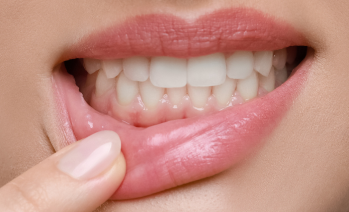 Blog - London Dental Arts