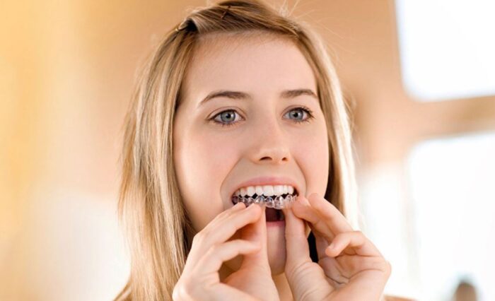Blog - London Dental Arts