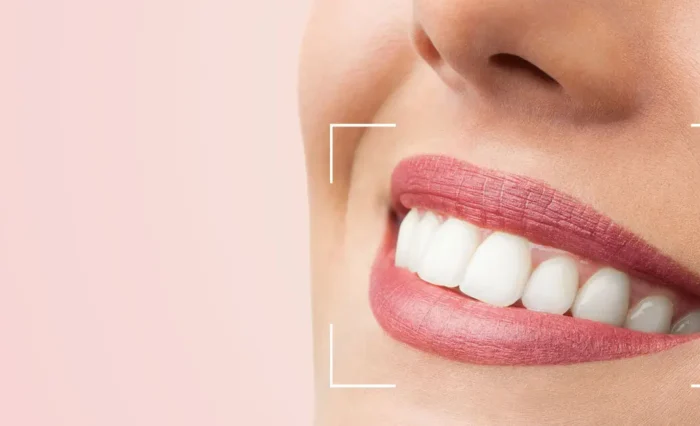 Blog - London Dental Arts